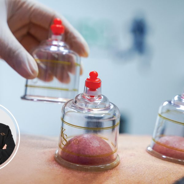 Dynamic Cupping Course